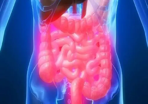 برای جلوگیری از سنگ کیسه صفرا چی بخوریم؟


