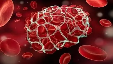 درمان موارد لخته شدن خون در مغز پس از واکسیناسیون کرونا