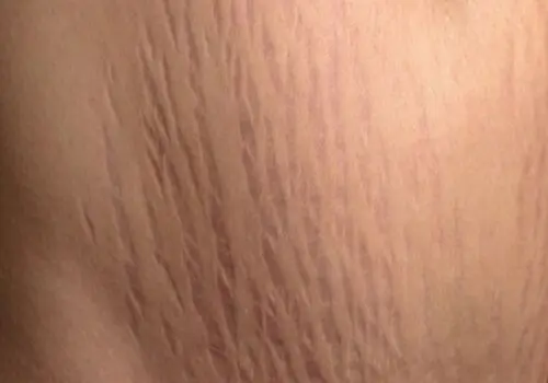 ۱۰ ماده غذایی که به بهبود جریان خون و سلامت عروق کمک می‌کنند