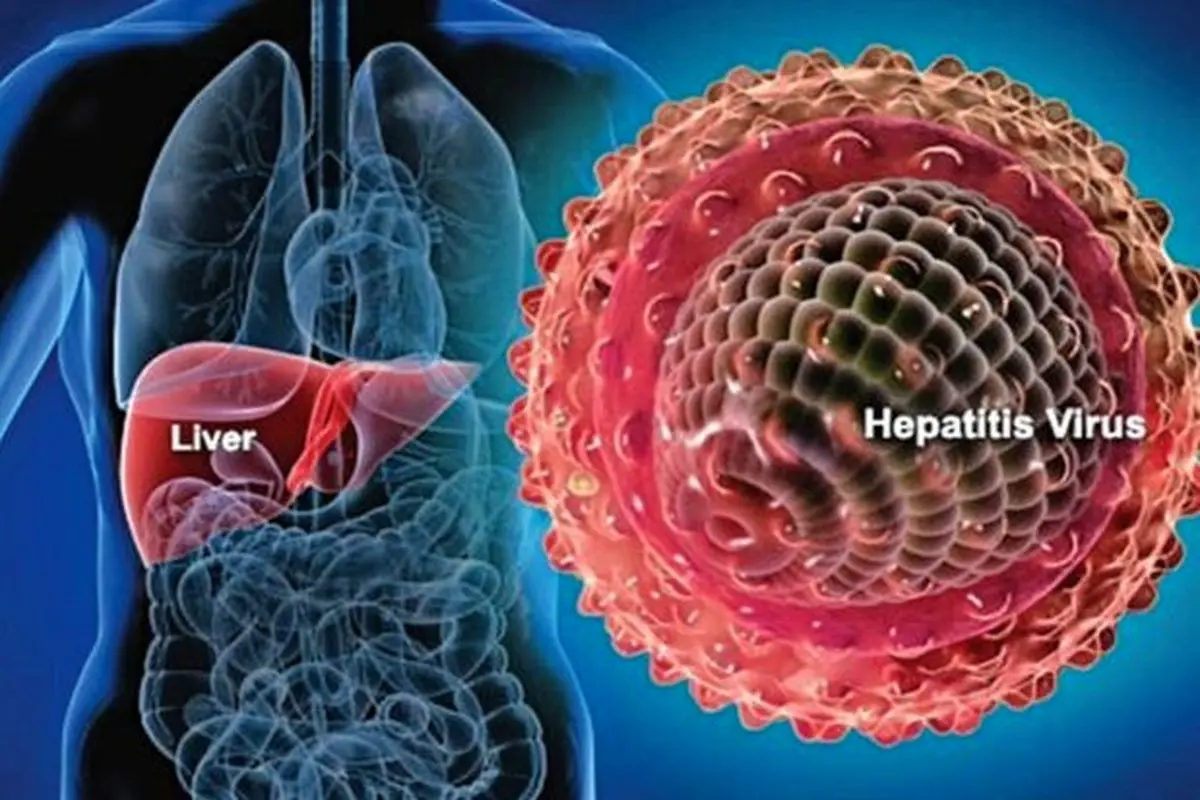 هپاتیت منجر به ناباروری می شود؟