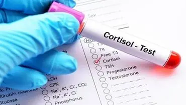 علائم کورتیزول بالا چیست؟ + راه‌ های پایین آوردن آن