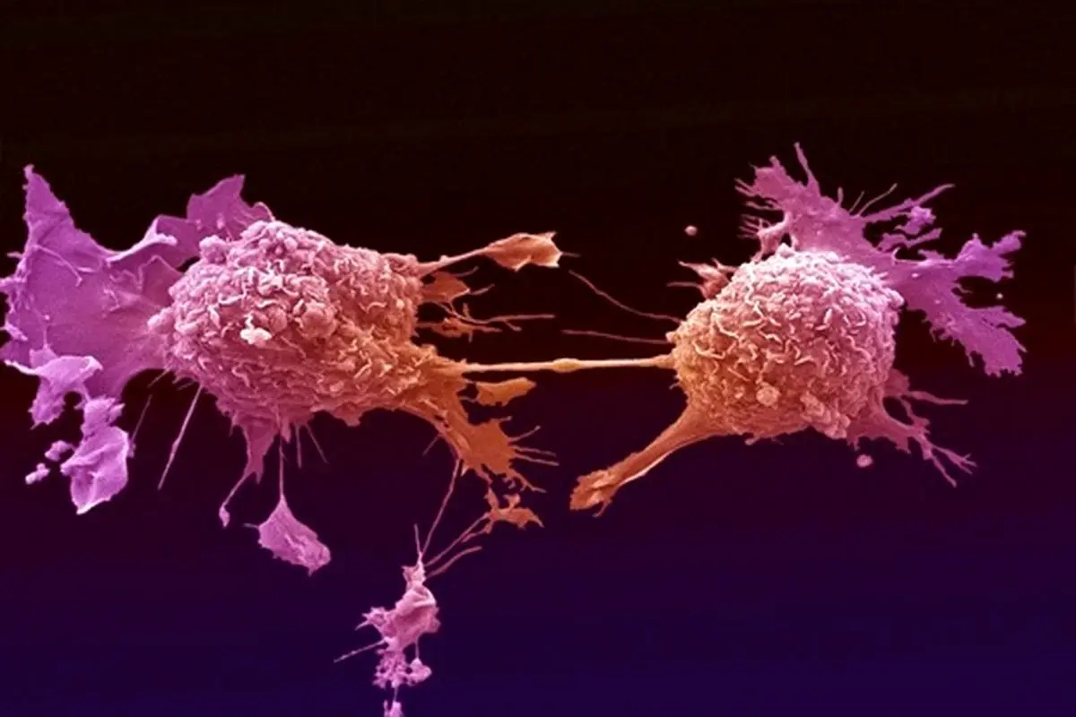 تومور‌های سرطانی تا چه اندازه می‌توانند در برابر درمان مقاومت کنند؟