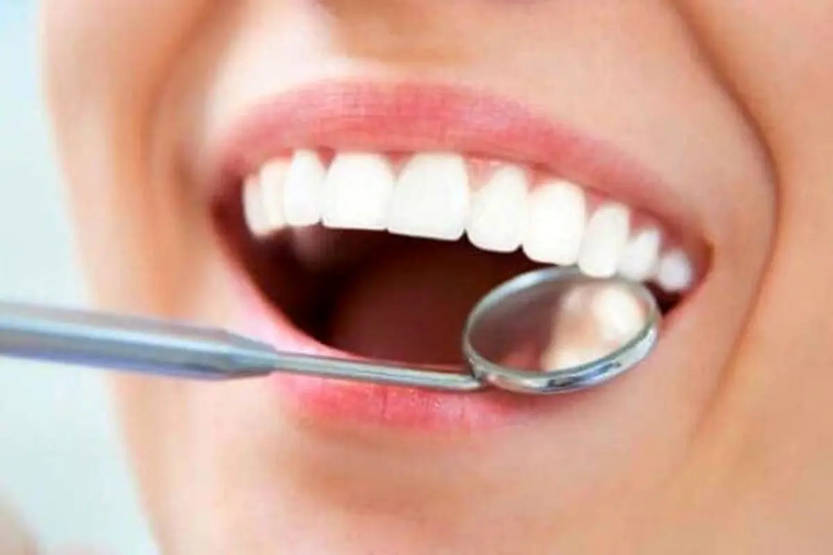 مواد غذایی و نوشیدنی هایی که برای دندان مضر هستند