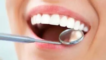 مواد غذایی و نوشیدنی هایی که برای دندان مضر هستند