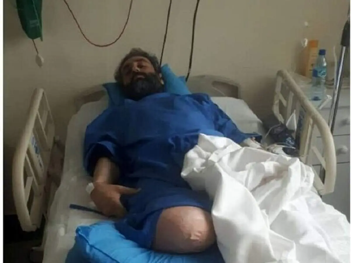 ناگفته‌های تنها محیط بان قطع عضو کشور