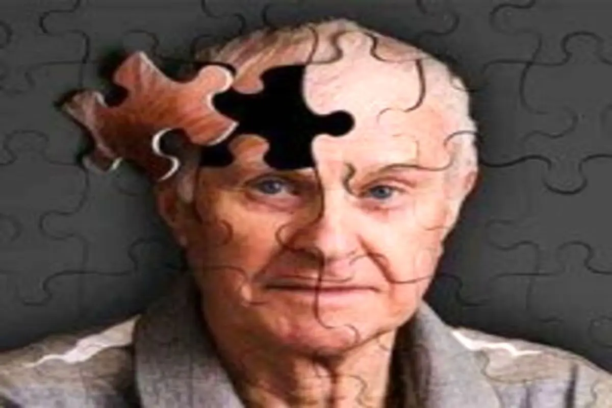 کشف نشانگر‌های آلزایمر در چشم