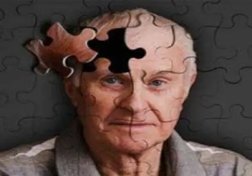 کشف هشداردهنده: رد پای آلزایمر در چشم انسان