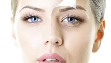 چگونه پوست خوبی داشته باشیم؟/ ویتامین‌های مفید برای سلامت پوست