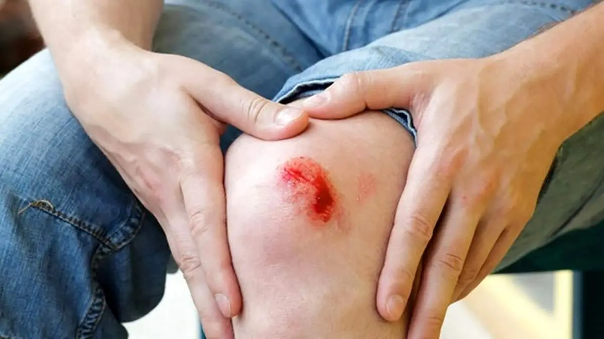 اندام‌هایی که توانایی ترمیم خود پس از آسیب را دارند