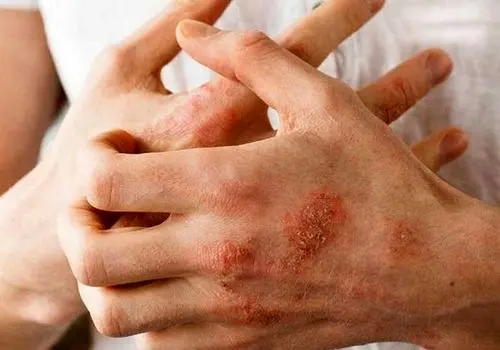 پوست شما چه رازی از سلامت‌تان فاش می‌کند؟ علائمی که می‌توانند خطرناک باشند