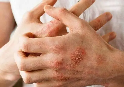 پوست شما چه رازی از سلامت‌تان فاش می‌کند؟ علائمی که می‌توانند خطرناک باشند