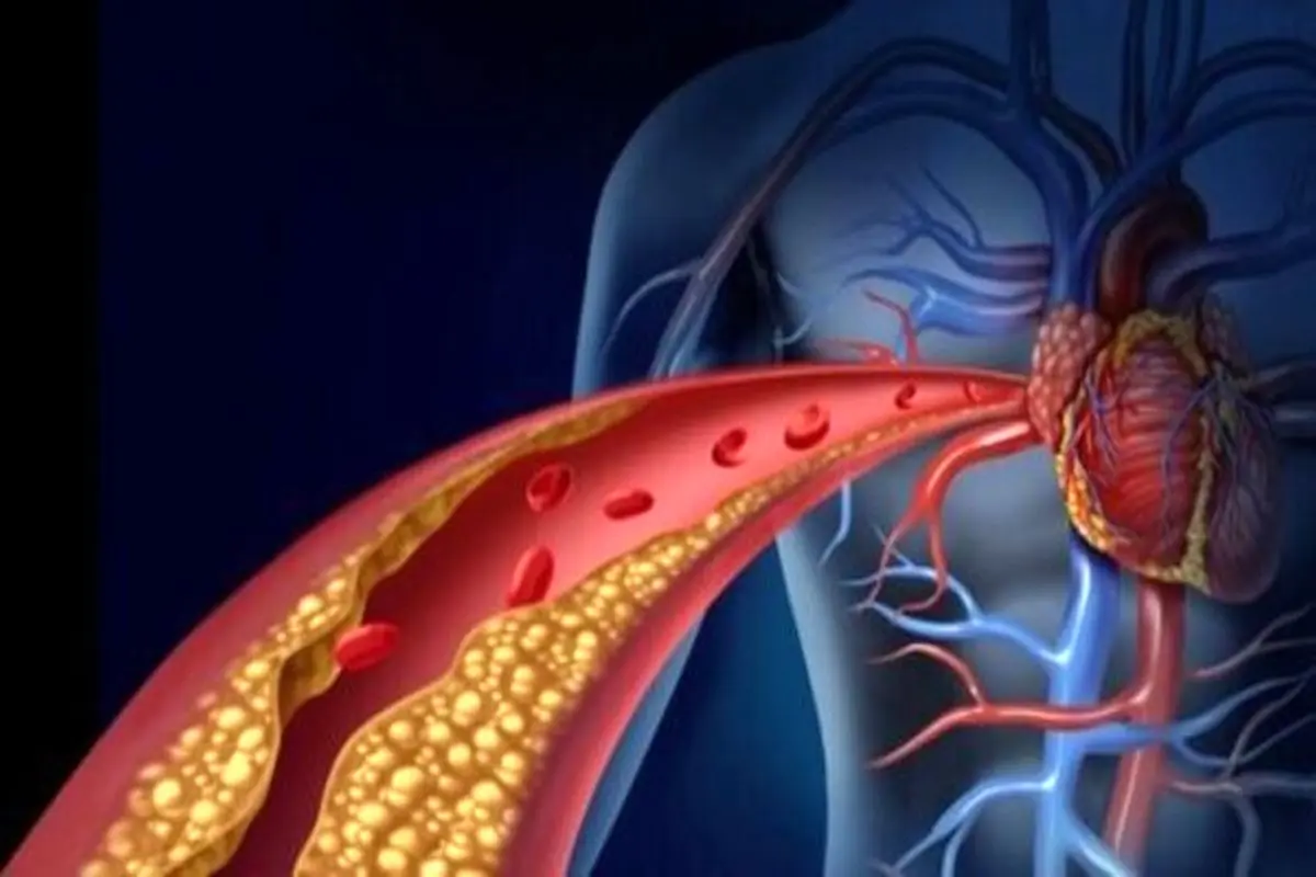 کشف پروتئینی که از تصلب شرایین محافظت می‌کند