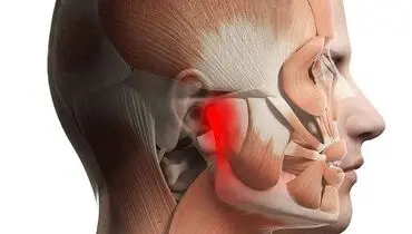 اصلی‌ترین دلایل بروز درد در ناحیه صورت