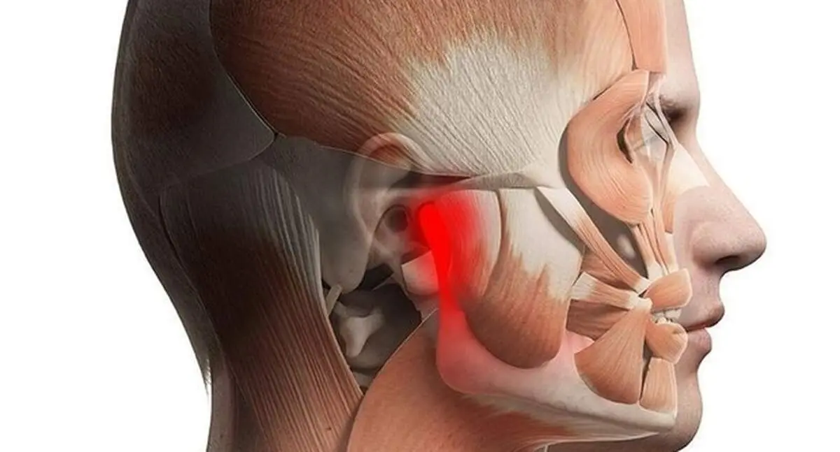 اصلی‌ترین دلایل بروز درد در ناحیه صورت