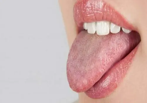 آلرژی غذایی از چه زمانی در افراد آغاز می‌شود؟