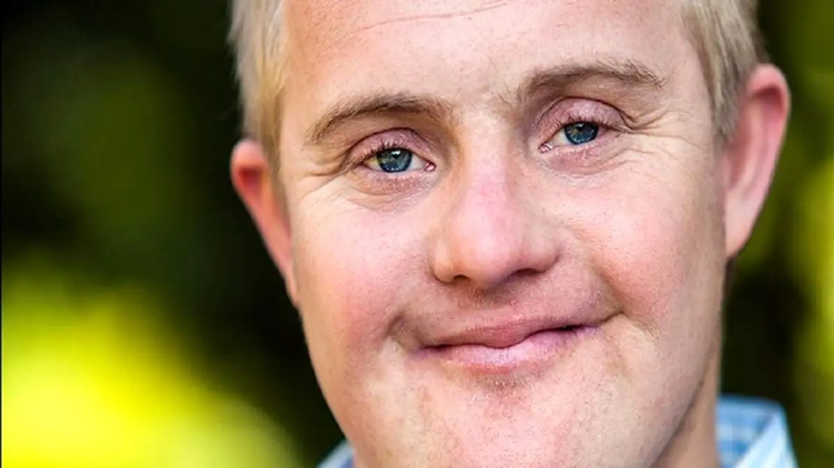 توقف زوال عقل در بیماران مبتلا به سندرم داون