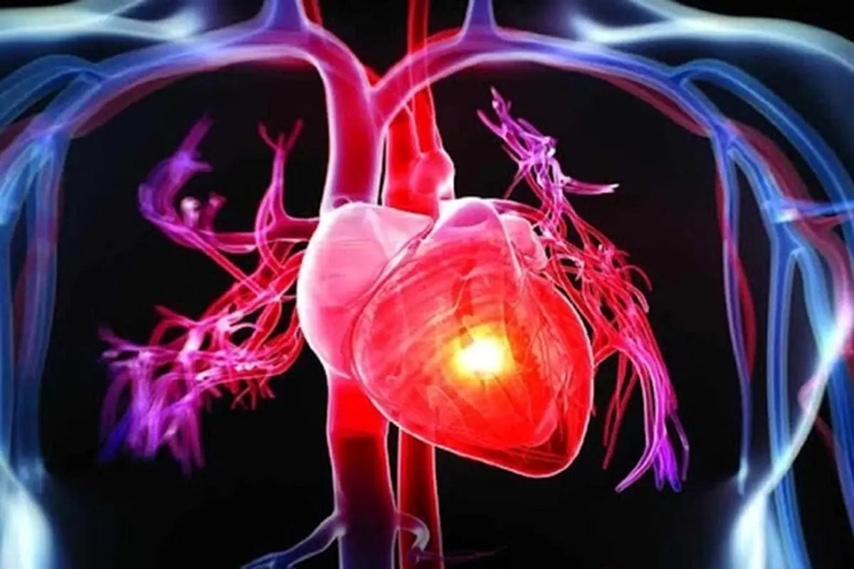 معجزه مصرف سیر در درمان بیماری‌های قلبی