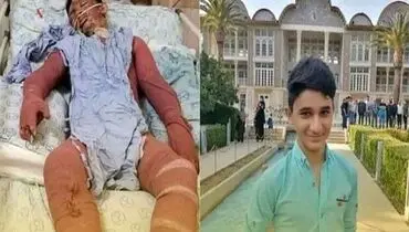 پیگیری فوری درمان نوجوان ۱۵ ساله ایذه‌ای + فیلم