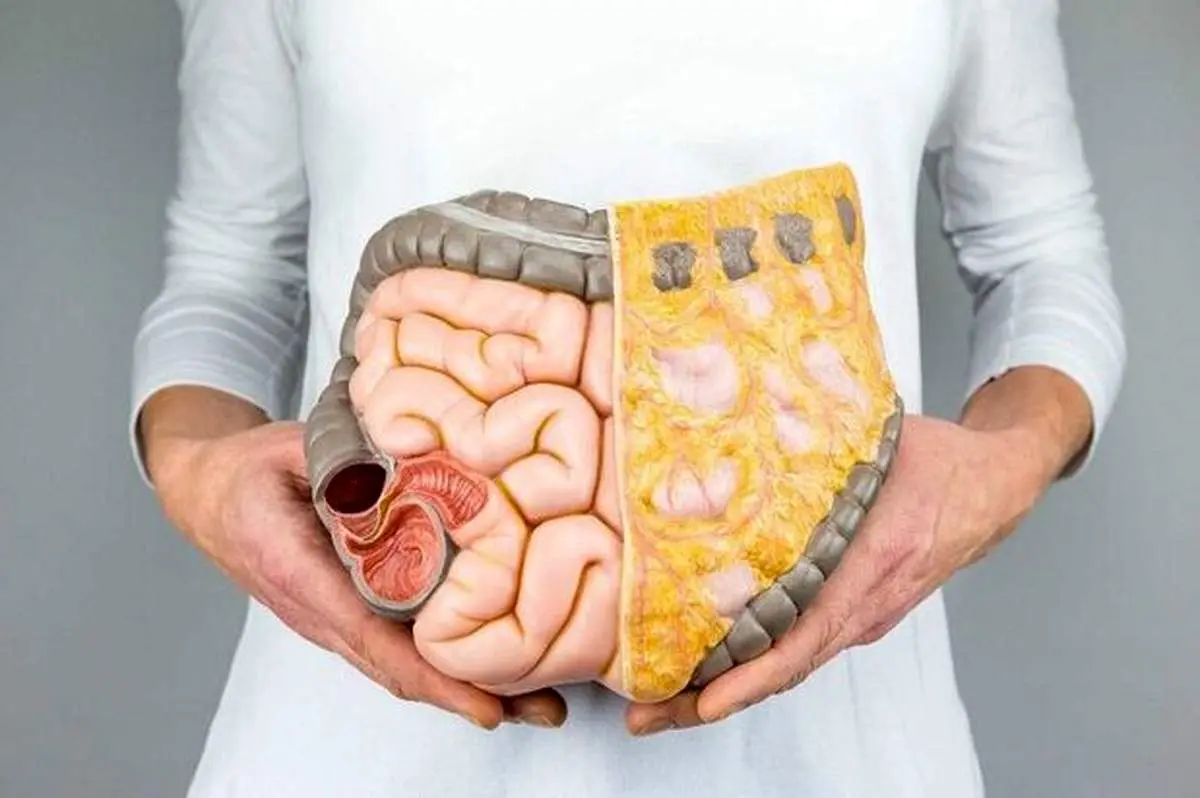 ۶ ماده غذایی حاوی پروبیوتیک به غیر محصولات لبنی