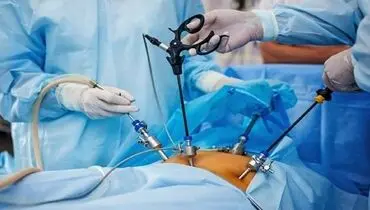 عوارض خطرناک جراحی‌های لاغری برای بدن