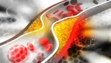 چربی خون موجب پیشرفت سرطان می‌شود؟