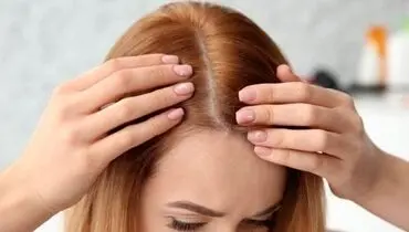 پیشگیری از ریزش موها با ۷ خوراکی خوشمزه