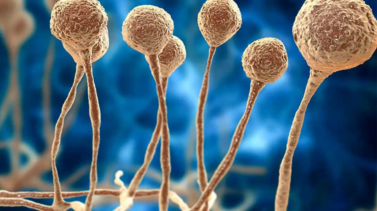 قارچ سیاه در افراد سالم عفونت می کند؟