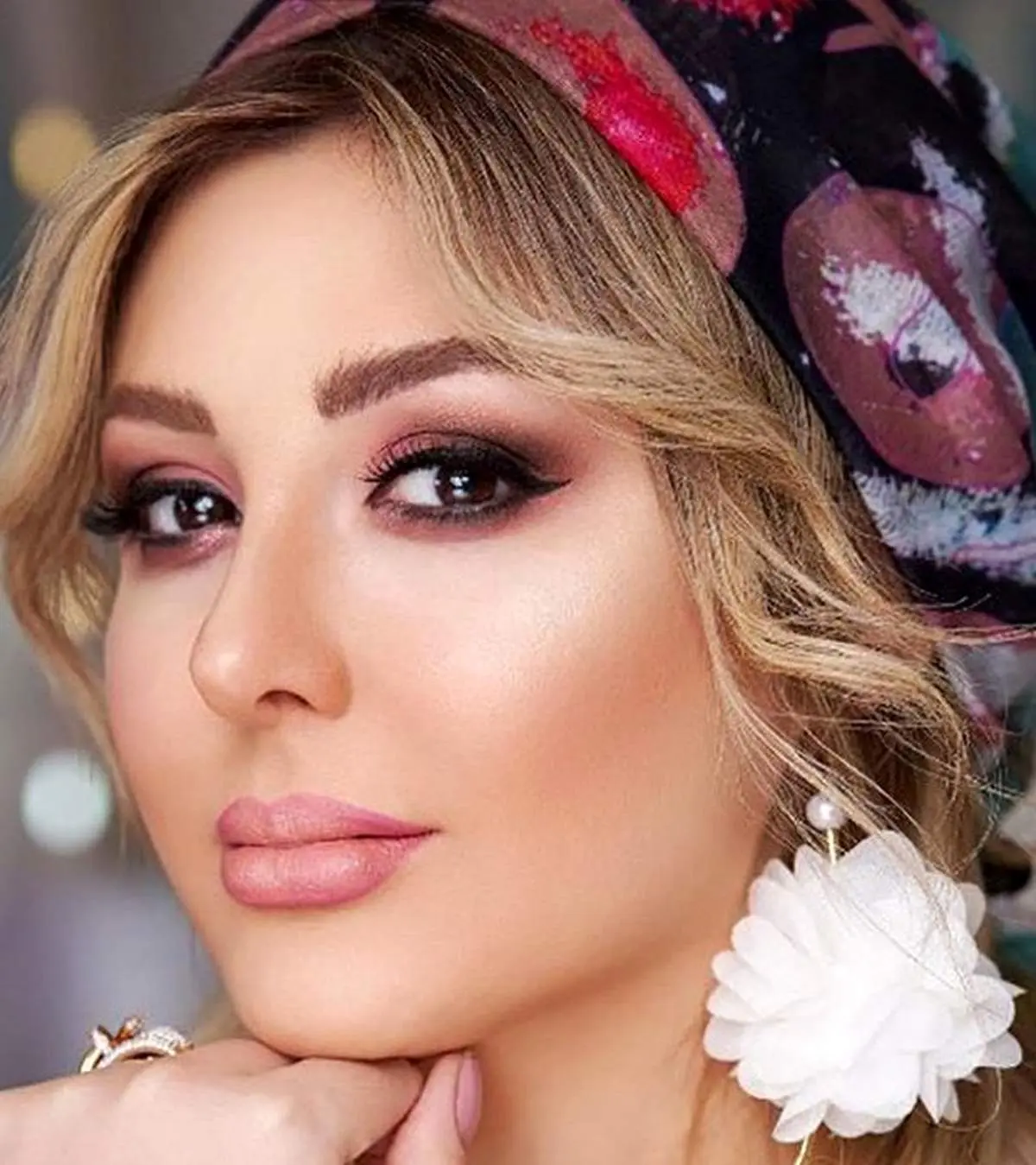 تصادف بازیگر سرشناس و محبوب/ صورت خونین نیوشا ضغیمی جنجال آفرین شد!