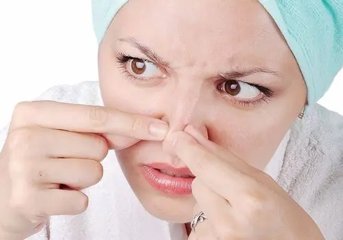 با این ترفند ساده، جوش‌های سرسیاه بینی را در خانه حذف کنید! 