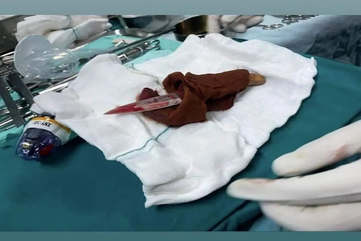 حمله خونین مرد چاقوکش به پرستار بیمارستان شهدای تجریش + عکس‌ تکان‌دهنده