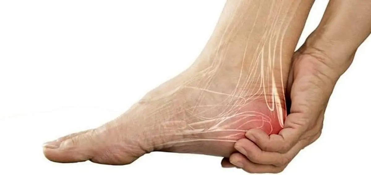 علت درد پاشنه پا هنگام راه رفتن چیست؟