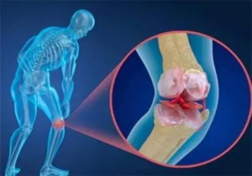 از کجا بفهمیم کمبود کلسیم داریم ؟