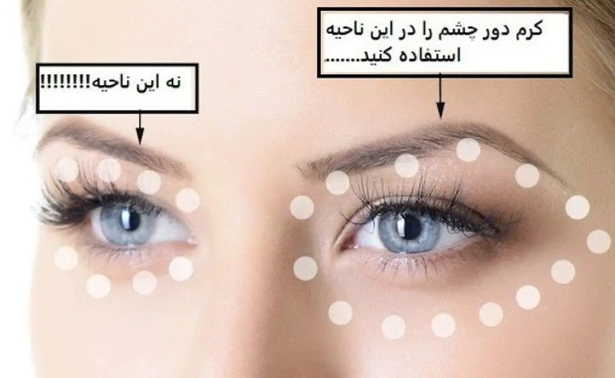 کرم دور چشم را چطور و کجا باید زد؟