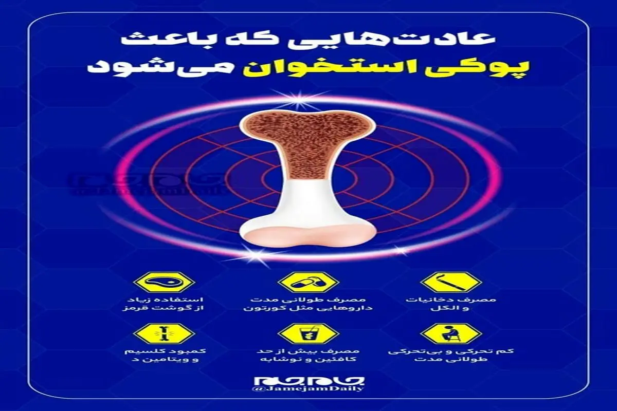 عادتهایی که باعث پوکی استخوان میشود +اینفوگرافی