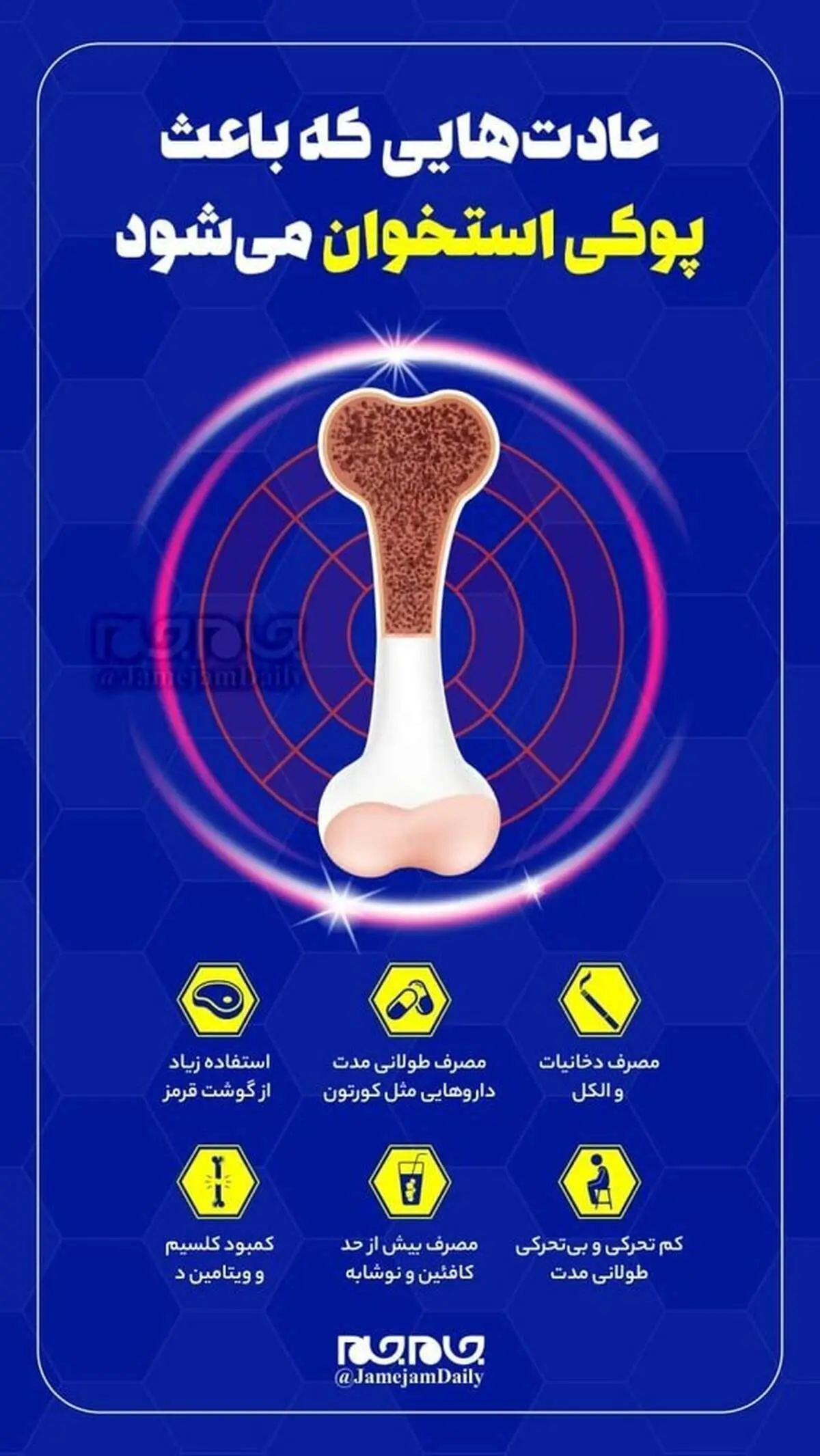 عادت‌هایی که باعث پوکی استخوان می‌شود +اینفوگرافی