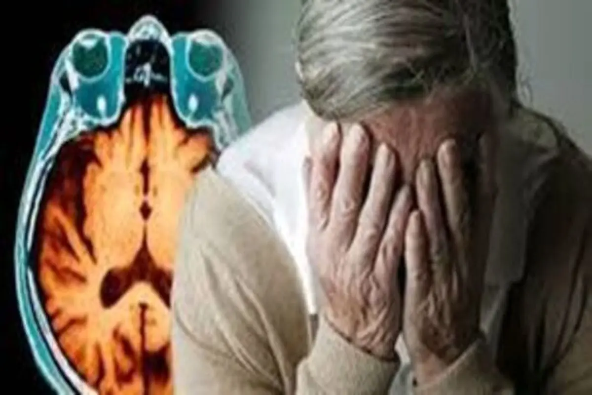 رابطه میزان خواب و بیماری آلزایمر