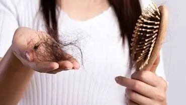 تا چه اندازه ریزش مو در یک روز طبیعی است؟ +جزئیات