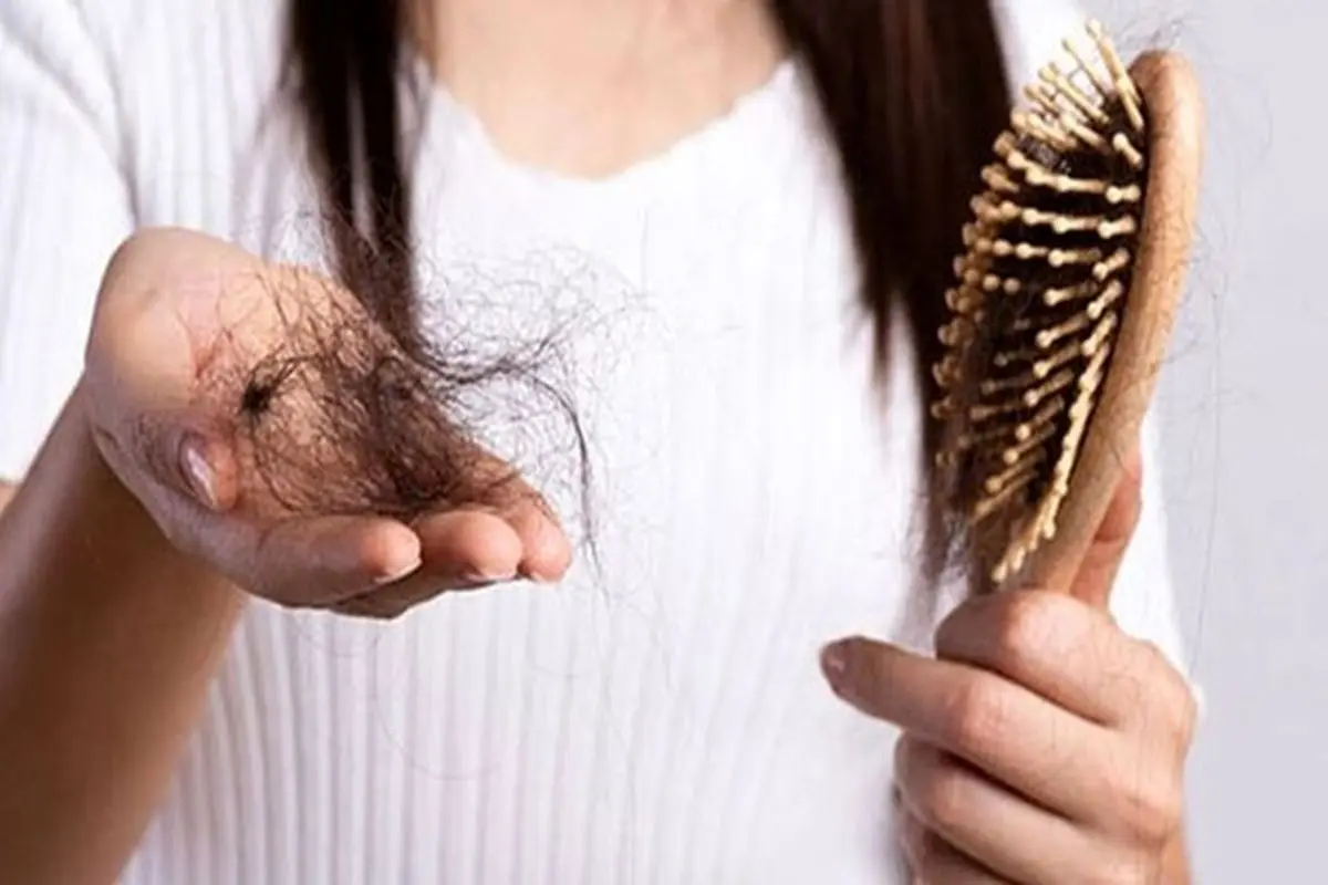 تا چه اندازه ریزش مو در یک روز طبیعی است؟ +جزئیات