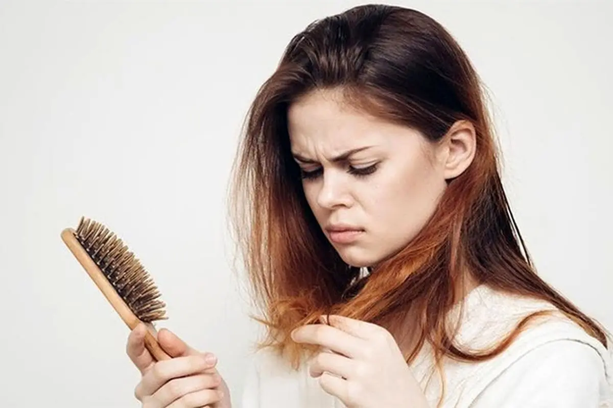 علل و درمان ریزش مو در زنان