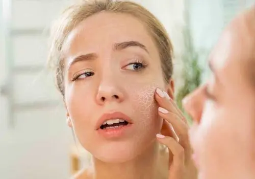 چگونه در فصل سرد از پوست مراقبت کنیم؟