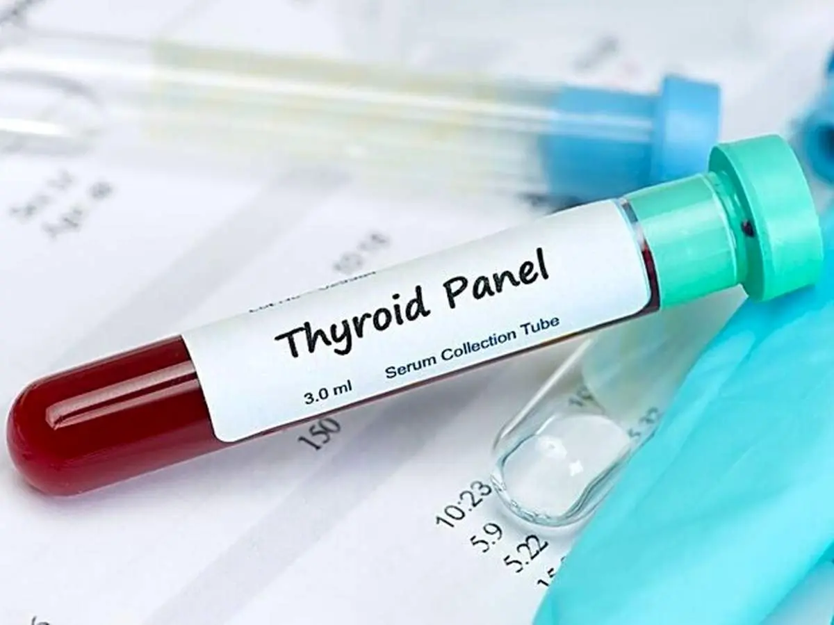 آزمایش تیروئید؛ علائم بیماری ها و انواع آن که باید بدانید