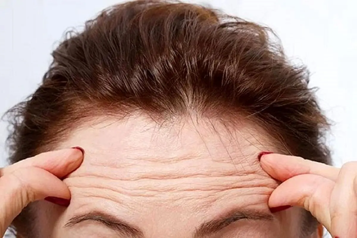 هشدار؛ چروکهای صورت از یک بیماری مرگبار خبر میدهند