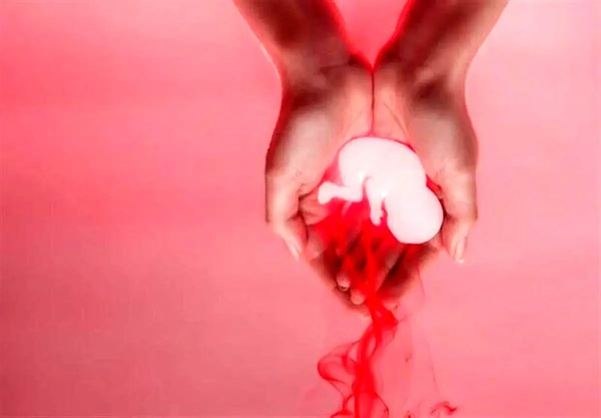 دلیل سقط جنین ۴۰ درصد زنان اعلام شد