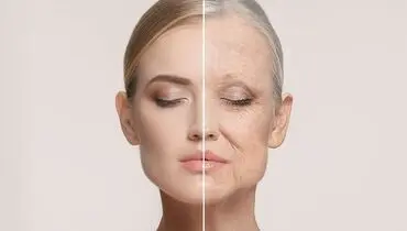چگونه به جنگ پیری پوست برویم؟