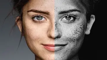 آلودگی هوا قاتل زیبایی پوست