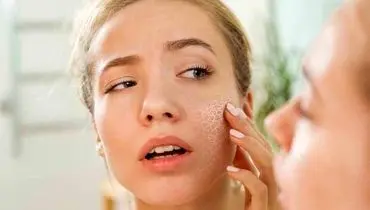 تکنیک های خانگی فوق العاده برای رفع خشکی پوست