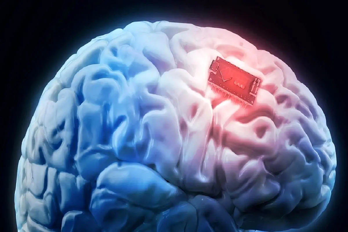 آمادگی تراشه مغزی ایلان ماسک برای آزمایش‌های انسانی
