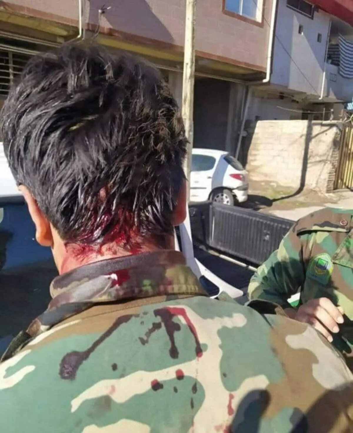 زخمی شدن جنگلبان وظیفه شناس با سلاح سرد/ انتقال جنگلبان مصدوم به بیمارستان ۵ آذر