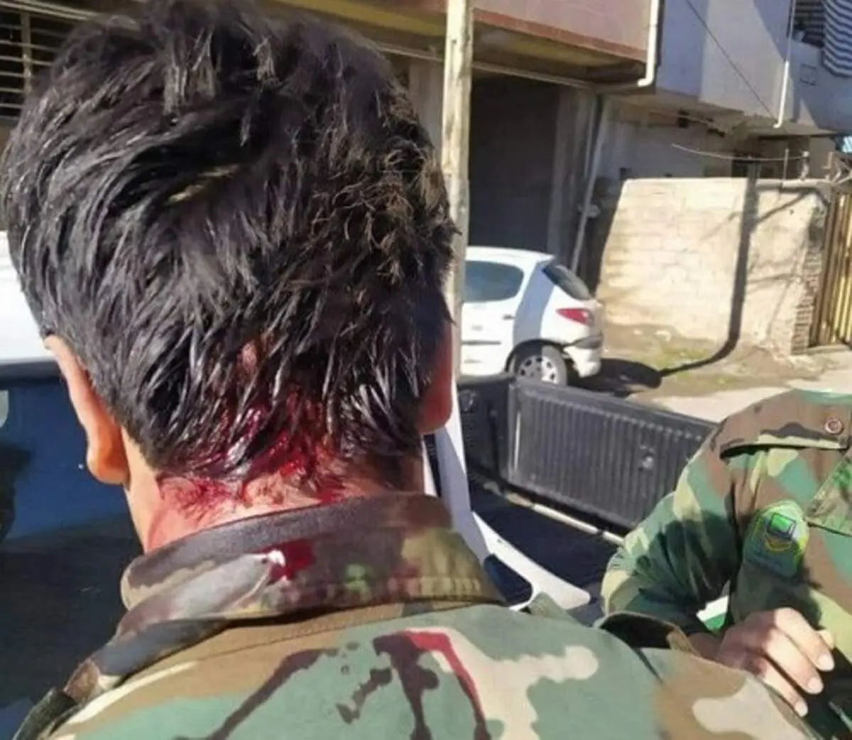 زخمی‌شدنِ جنگلبان وظیفه‌شناس با سلاح سرد + عکس