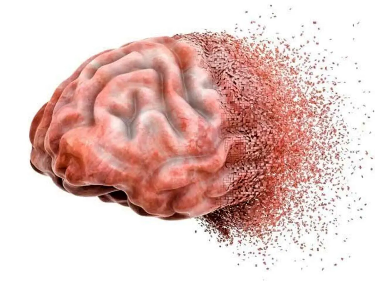 چگونگی تشخیص زوال عقل
